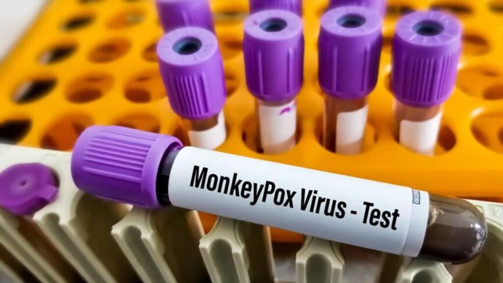 ICMR offers Indian firms technology to develop quick Mpox test kits